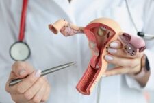 doctor's hands hold a sectional model of the female reproductive organs, close-up for explaining in gynecology and obstetrics