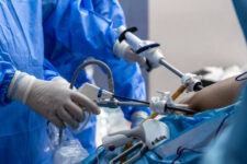 a surgical room during a laparoscopy procedure